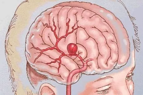 1524908623132060763F.png QQ截图20180428174224.png