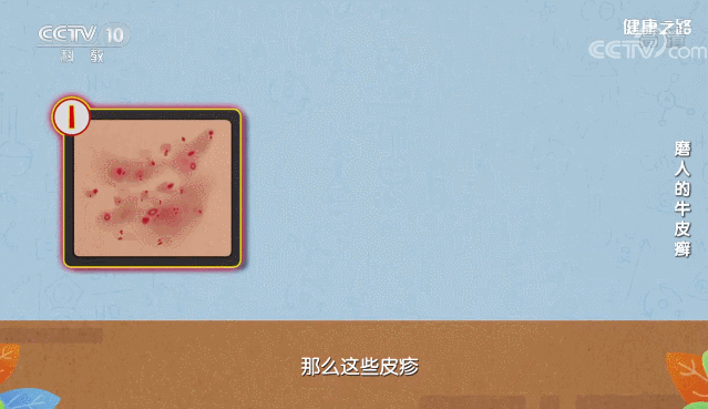 1.gif