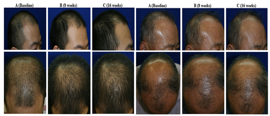 1675216315531141C62B.png 微信图片_20230201094638.png