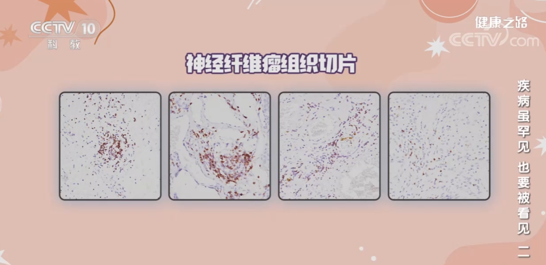 16780694818014661417.png 微信图片_20230306093734.png