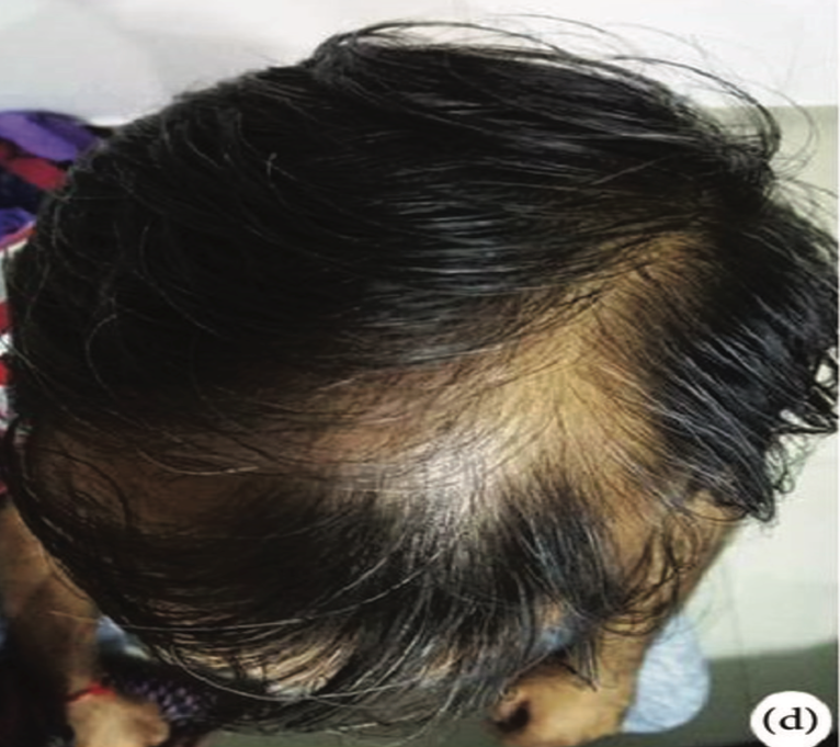 1690165046469993F095.png 3.png