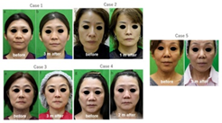 16917205124113839732.png 2.png