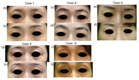 1691720585137378B2D9.png 6.png