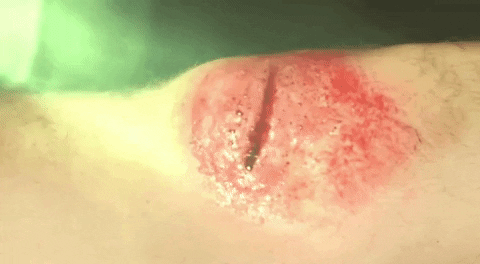 6.gif