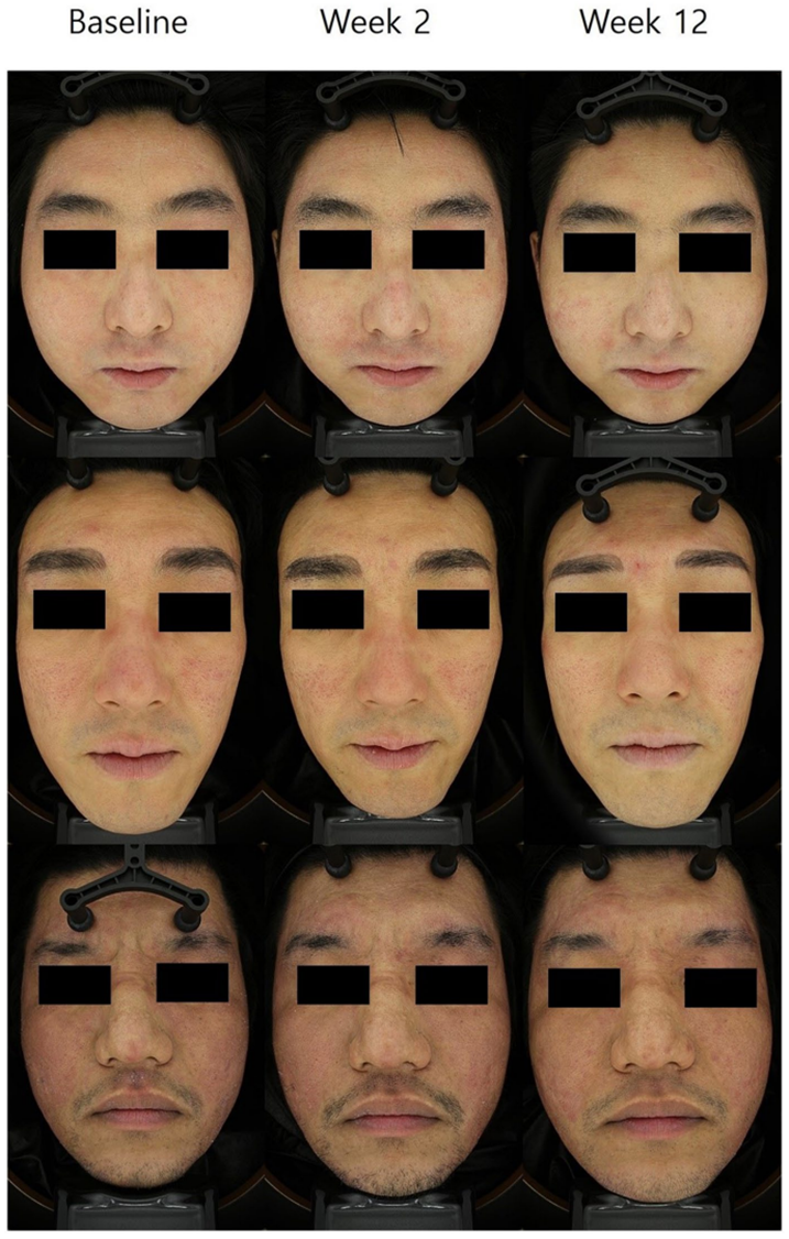4.png