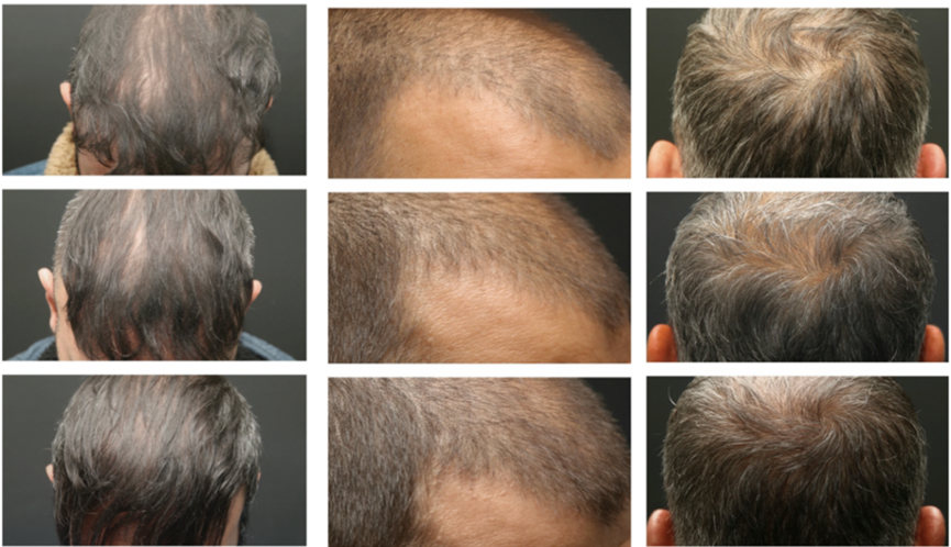 1760685339887444681A.png 微信图片_2025-10-17_134531_105.png