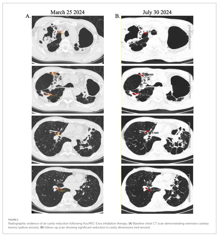 17612969476067914AC3.png 3.png